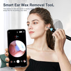 Ear Wax Removal, Ear Wax Removal Tool Camera Builtin 1296P