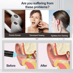 Ear Wax Removal, Ear Wax Removal Tool Camera Builtin 1296P