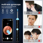 Ear Wax Removal, Ear Wax Removal Tool Camera Builtin 1296P
